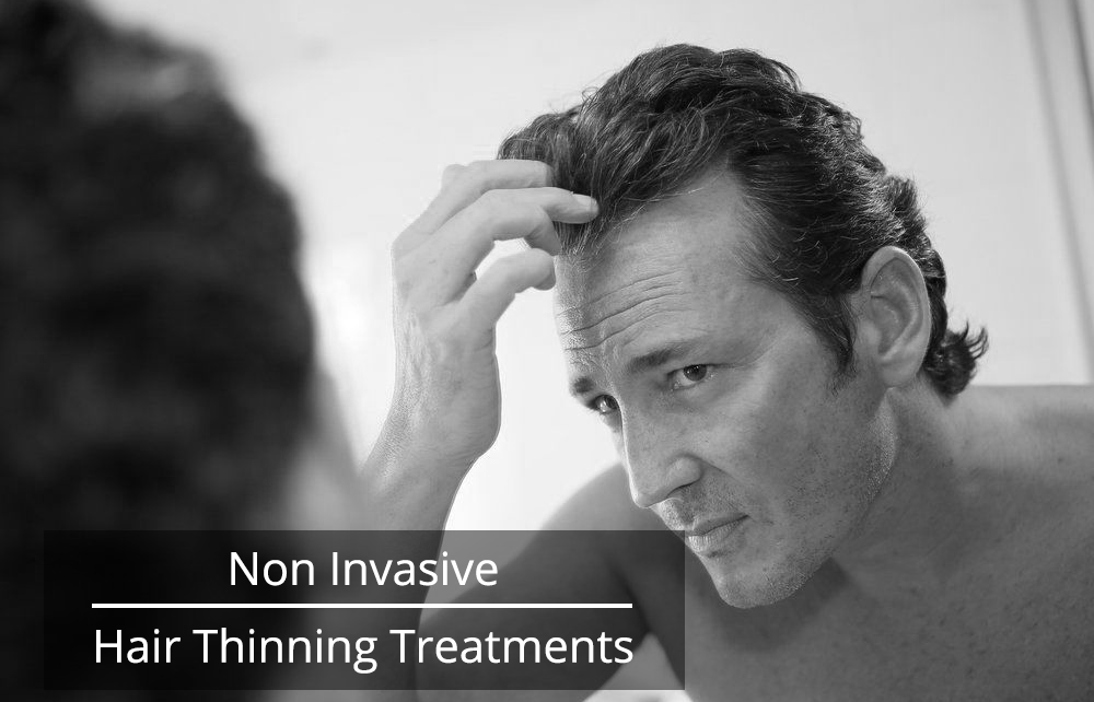 Non Invasive Hair Thinning Treatments